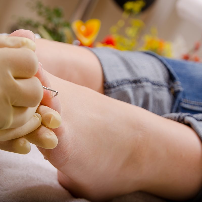 Fußpflege Behandlung